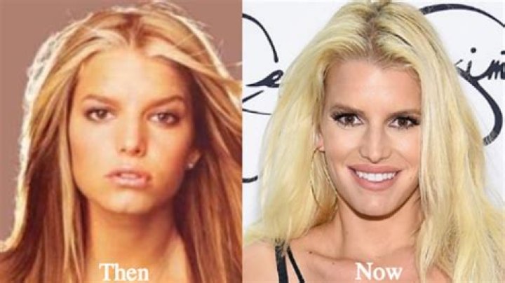 Jessica Simpson Nose Job: Before And After Photos