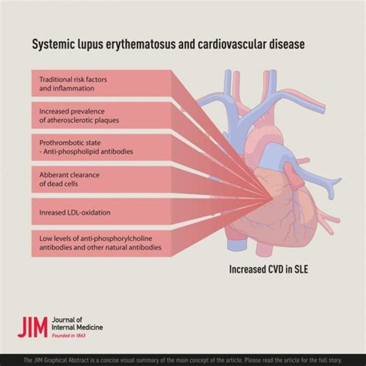 Zhou Hai Mei Death: Lupus Erythematosus Diagnosis